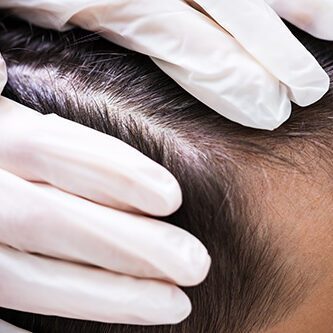 Express lice treatment